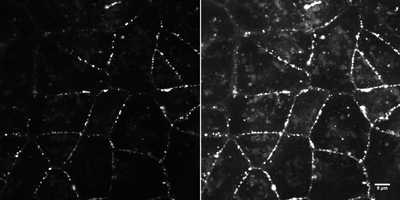 Cell line media